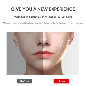 Herramienta de belleza para el cuidado de la piel, masajeador de microcorriente para estiramiento facial, dispositivo de estiramiento facial en forma de <span class=keywords><strong>V</strong></span> - Product Image 5