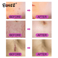 Nouveau Rouleau Derma Matériel Pour Soins Capillaires Traitement Facial Beauté Rouleaux Derma 192 Rouleau Derma Pour Cheveux