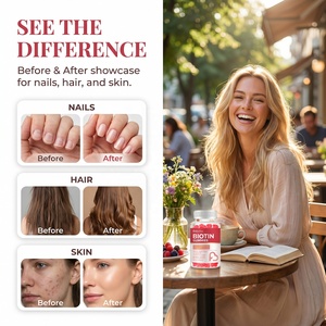 Caramelle Gommose OEM Private Label per la Crescita dei Capelli <span class=keywords><strong>con</strong></span> Biotina, Collagene e Cheratina, Integratore Sbiancante <span class=keywords><strong>con</strong></span> <span class=keywords><strong>Vitamina</strong></span> <span class=keywords><strong>C</strong></span> per Capelli, Pelle e Unghie - Product Image 2