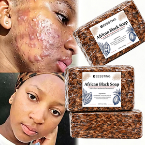 Barra Sólida Limpiadora y Exfoliante Profunda para Piel Sensible, Hidratante, Iluminadora y Blanqueadora, Hecha a Mano en África - Product Image 1