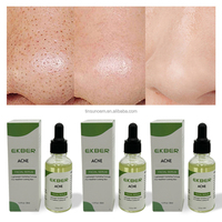Sérum Anti-Acné aux Acides de Fruits Naturels, Réparateur et Éclaircissant, Élimination des Marques d'Acné, Étiquette Privée avec Logo Personnalisé