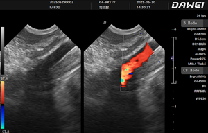 Máquina de Ultrasonido Portátil para Diagnóstico de Mascotas (Perros y Gatos) Dawei de Alta Sensibilidad con 6 Horas de Duración de Batería - Product Image 6