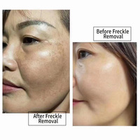 Crème Visage Intensive Anti-Taches Brunes, Correcteur de Taches de Rousseur, Éclaircissante, Traitement Anti-Pigmentation et Anti-Melasma, Peeling, kg