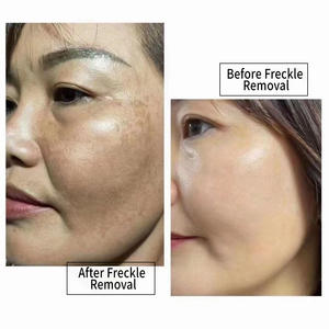 Crème Visage Intensive Anti-Taches Brunes, Correcteur de Taches de Rousseur, Éclaircissante, Traitement Anti-Pigmentation et Anti-Melasma, <span class=keywords><strong>Peeling</strong></span>, kg - Product Image 2