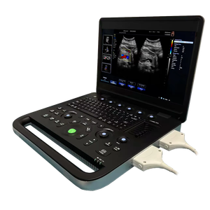 Meilleur prix pour un appareil d'échographie portable pour clinique et hôpital, avec option <span class=keywords><strong>3D</strong></span> - Product Image 1