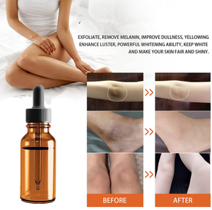 Aceite Exfoliante Amarillo <span class=keywords><strong>Extra</strong></span> Fuerte al por Mayor para Blanquear la Piel y Eliminar Manchas Oscuras en los Nudillos con Su Propia Marca - Product Image 4