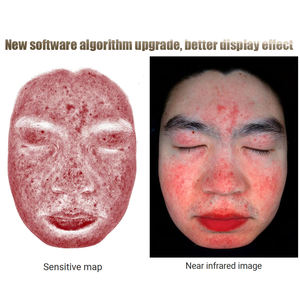 2025 Nieuwste Geüpgraded Plan B Schoonheid Huidanalyse Gezichtsscanner Huidanalysator Huidanalyse - Product Image 2