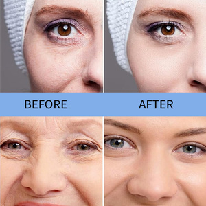 Sérum anti-rides instantané à étiquette privée, complexe de niacinamide pour le visage, sérum au peptide de cuivre - Product Image 6