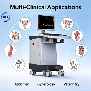 Machine à ultrasons Doppler écho couleur pour le balayage d'ultrasons humains obstétriques, cardiaques, urologiques - Product Image 6