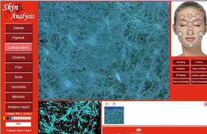 Mini análisis de prueba de piel, analizador de piel facial, máquina de escáner de piel <span class=keywords><strong>para</strong></span> la piel - Product Image 6