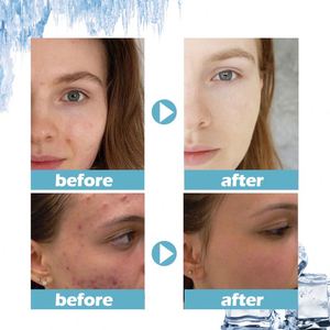 Masque de nuit hydratant et rafraîchissant pour les imperfections de la peau, marque privée West Month, 100g - Product Image 4