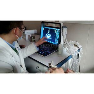 SYA-S90_vet veterinaria 15.6 pollici ad alta risoluzione a colori Doppler a ultrasuoni dispositivo diagnostico ecocardiografico macchina per animali domestici - Product Image 4