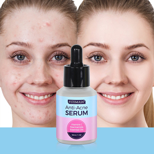 Sérum Traitant Anti-Acné et Anti-Cicatrices d'Usine : Élimine l'Acné et les Boutons, Répare le Visage - Product Image 3