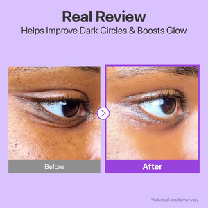 Crema de Ojos Coreana Eléctrica con NAD+, Péptidos Retinales y Niacinamida para Iluminar las <span class=keywords><strong>Ojeras</strong></span>, Gel Aclarante para Ojos, Fórmula Antiarrugas - Product Image 5