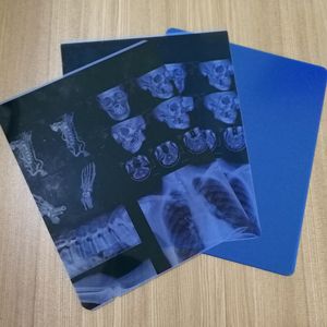 فيلم أشعة إكس أزرق ليزر نافث للحبر - Product Image 1