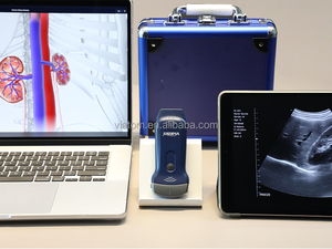 Avaliação da Rotina Ultrassonografia Obstétrica no Meio da Gravidez Ultrassonografia Obstétrica - Product Image 2