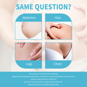 Crema Eficaz para la Eliminación de Cicatrices y la Reparación de Estrías con Colágeno y Ácido Hialurónico para Suavizar, Reafirmar y Combatir las Arrugas del Cuerpo - Product Image 4
