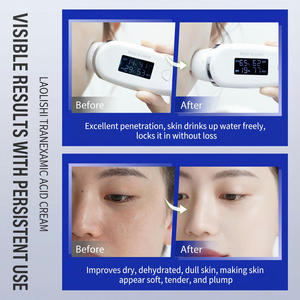 Crema Idratante Illuminante con Glicerina e Acido Tranexamico per Correzione Tonalità Giallastra e Opaca, Rassodante e Nutriente - Product Image 4