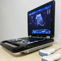 Sistem Ultrasound Digital K-C500 3D 4D Opsional Mesin USG Portabel Doppler Warna