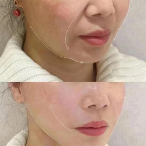 G New Microcurrent Ngón Tay Vàng Hấp Lực Kim Cương Ngón Tay Mặt Nâng Và Làm Săn chắc Chăm Sóc Sức Khỏe Vẻ Đẹp Máy - Product Image 6