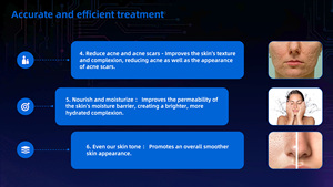 Microagujas <span class=keywords><strong>de</strong></span> Radiofrecuencia Fraccionada a Precio <span class=keywords><strong>de</strong></span> Fábrica, Tensado <span class=keywords><strong>de</strong></span> la Piel, <span class=keywords><strong>Cicatrices</strong></span> <span class=keywords><strong>de</strong></span> Acné/Estrías, Microagujas <span class=keywords><strong>de</strong></span> Radiofrecuencia Fraccionada - Product Image 5