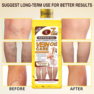 Massage des veines variqueuses des mollets, application d'<span class=keywords><strong>huile</strong></span> <span class=keywords><strong>essentielle</strong></span>, favorisant la circulation sanguine, détente des jambes. - Product Image 2
