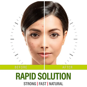 Cápsulas de Niacinamida y Biotina de Marca Privada OEM/ODM para Piel Grasa en Adultos, Suplemento Vitamínico para una Piel Naturalmente Limpia, Contra el Acné - Product Image 2