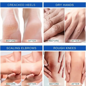 Crème de massage à l'huile de lavande et à l'urée, marque privée OEM, pour adoucir et hydrater les talons gercés, les mains sèches, les coudes exfoliés et les genoux rugueux - Product Image 5