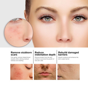 Suero Facial con Niacinamida EELHOE, Desvanece Marcas de Acné, Hidrata y Humecta, Reduce los Poros, Blanquea y Embellece la Piel, 50 ml - Product Image 5