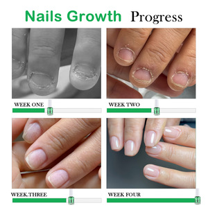 Stylo anti-morsure d'ongles, sûr pour les enfants, imperméable, dissuasif pour empêcher de sucer les pouces et de mordre les ongles - Product Image 4