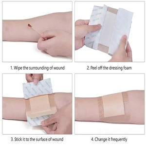 Jaring luka tekanan negatif perekat diri muka transparan NPWT perawatan luka - Product Image 5