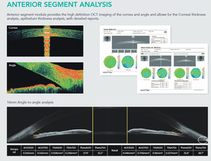 Optik SJ Okt Ophthalmological 2800 segmen depan dan posior optik Okt tomografi penghasil optik - Product Image 4