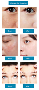 เครื่องทำความสะอาดผิวหน้า 8-in-1 ไฮโดรเดอร์มาเบรชั่น ออกซิเจนพีล เจ็ท อควา บับเบิ้ลเล็ก พร้อมฟังก์ชั่นเติมความชุ่มชื้นด้วยออกซิเจน อุปกรณ์เสริมความงาม วัสดุ ABS ขนาดเล็ก - Product Image 3