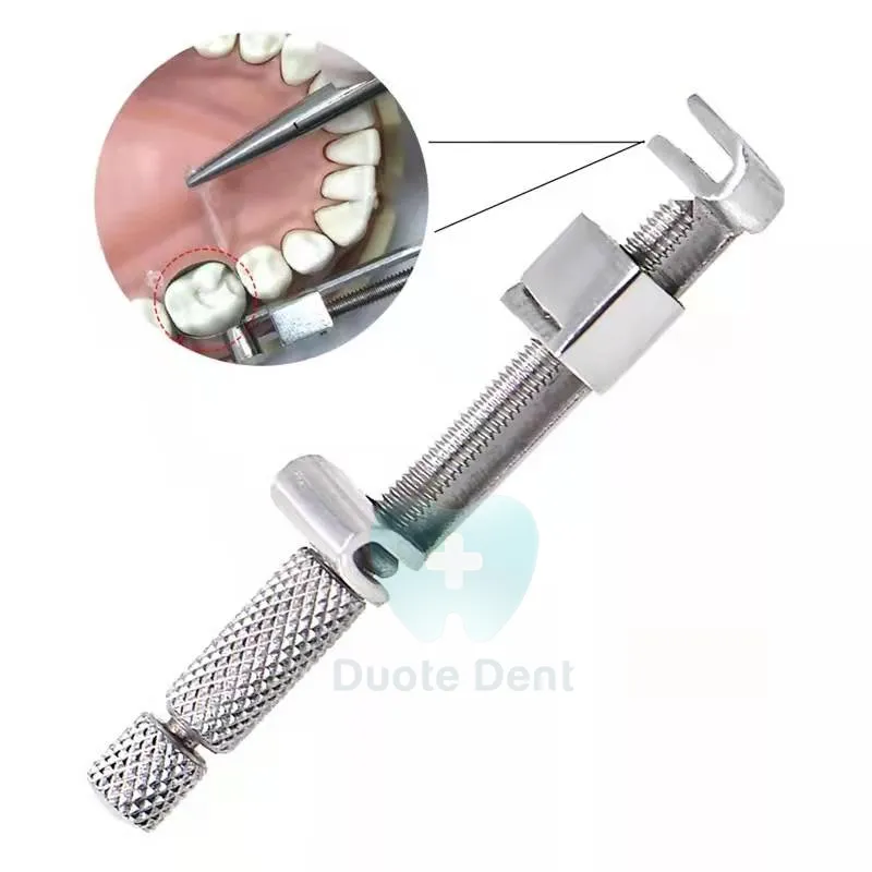 Matriz dental ortodôntica universal, bandas de matriz em aço inoxidável para retentores 5 /6 /7mm, clipe formado matriz