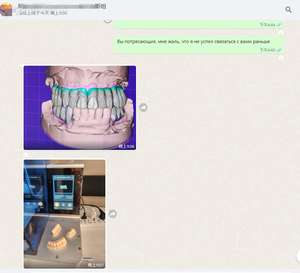 Impresora 3D de Resina Yucera, Máquina Impresora LCD Dental, Mejor Precio para Laboratorios y Clínicas Dentales - Product Image 6