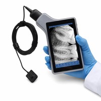 Nuevo Sistema de Imágenes Digitales Portátil con Sensor y Pantalla, Sistema de Imágenes Intraorales para Diagnósticos Inmediatos