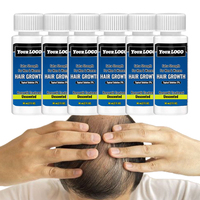 Huile capillaire nourrissante bio personnalisée pour la repousse des cheveux bouclés, formule à la biotine, traitement de croissance super rapide 5%