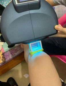 Système Excimer Portable Peninsula 308nm CE Lampe Excimer Laser Uvb Traitement du <span class=keywords><strong>Vitiligo</strong></span> - Product Image 3