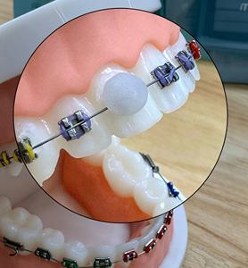 Cire de soulagement dentaire colorée sans découpe, aromatisée aux fruits, pour points de rupture de laboratoire dentaire et appareils orthodontiques <span class=keywords><strong>Invisalign</strong></span> - Product Image 6