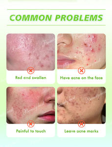 にきび除去クリームハーブリペアカスタマイズされたロゴ赤みを和らげ、痛みを浄化し、滑らかな肌 - Product Image 4