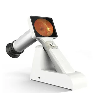 HFC-100 офтальмологический инструмент цифровой портативный глазное дно-камера офтальмологическое оборудование