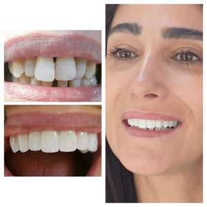 <span class=keywords><strong>Vsmile</strong></span> Produits en gros Haute translucide Plus Couleur Preshade 3d Pro Bloc de zircone pour poudre dentaire Cad Cam - Product Image 6