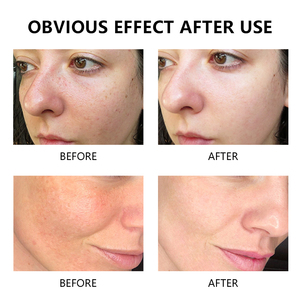 <span class=keywords><strong>Crema</strong></span> Facial de Marca Privada para el Cuidado de la Piel, Antienvejecimiento, Reafirmante e Iluminadora, con Colágeno Natural y Vitamina C en Cápsulas - Product Image 4