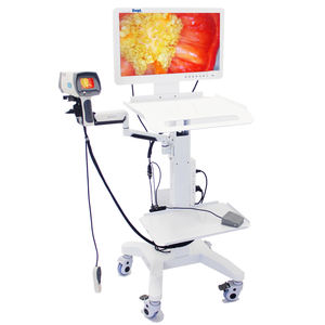 Medische HD Gynaecologie Video Colposcopie Elektronische Video Colposcoop voor Vrouwen Colposcopie voor Gynaecologie - Product Image 3