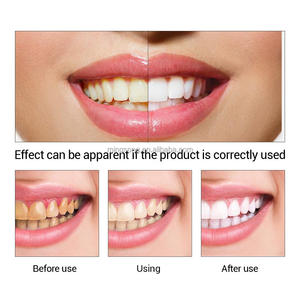 Wholesale Teeth Whitening Oral Hygiene Cleaning Serum <strong>Remove</strong> <strong>Plaque</strong> Stains Tooth Bleaching <strong>Tools</strong> Dental Care Toothpaste - Product Image 3