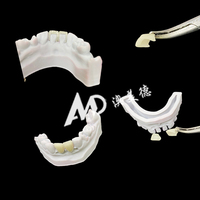 Veneers en porcelaine dentaire pour cliniques et laboratoires dentaires |   Placages en stratifié E.max sur mesure ultra-fins OEM/ODM pour un sourire éclatant
