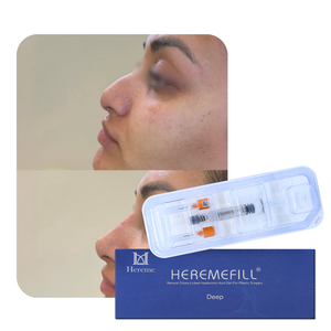 Inyector de Ácido Hialurónico <span class=keywords><strong>para</strong></span> Nariz y <span class=keywords><strong>Labios</strong></span>, Jeringa <span class=keywords><strong>para</strong></span> Relleno Dérmico HA, Pluma de Ácido Hialurónico <span class=keywords><strong>para</strong></span> Relleno Dérmico de Nariz y <span class=keywords><strong>Labios</strong></span> - Product Image 4