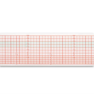 112mm*90mm-150p Ziekenhuisapparaat Foetale Monitor Papier CTG Papier Registratie Medisch CTG Papier - Product Image 5