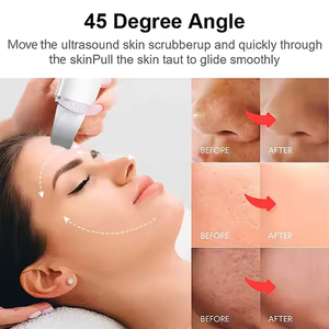 เครื่องทำความสะอาดผิวหน้าแบบสั่นสะเทือน รุ่น Esptula Ultrasnica สำหรับขจัดสิ่งสกปรกในรูขุมขน  ที่ขูดผิวหน้า  ทำจากสแตนเลส - Product Image 3