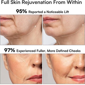 Home Facial Massage Device with Warm <b>Therapy</b>, Vibration Cleansing and V-Line Skin Lifting Function - Product Image 4